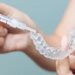 Invisalign w Szczecinie