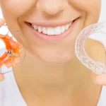 Aparat nakładkowy Invisalign z Warszawy