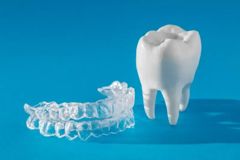 Co to jest Invisalign?