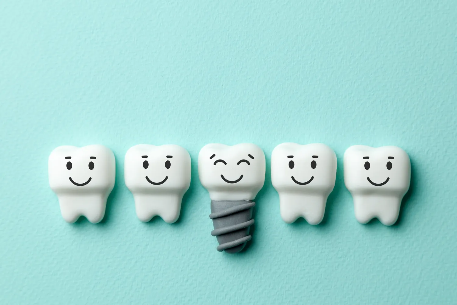 Ile kosztują implanty stomatologiczne?